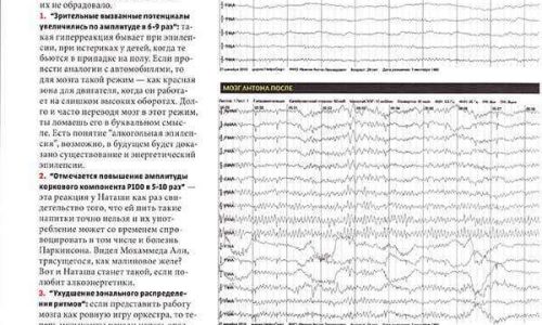 Статья в Men's Health: Антон Иванов проходит ЭЭГ-исследование под наблюдением Рината Гимранова для изучения влияния алкогольных энергетиков на мозг.