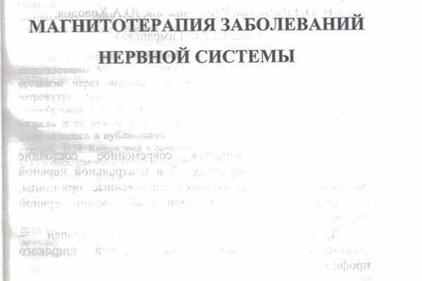 Титульный лист книги 'Диагностика заболеваний нервной системы'. Авторы: Р.Ф. Гимранов, Ж.В. Гимранова и др., 2003