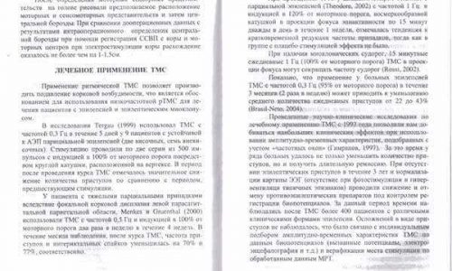 Разворот книги с текстом о лечебном применении транскраниальной магнитной стимуляции (ТМС)