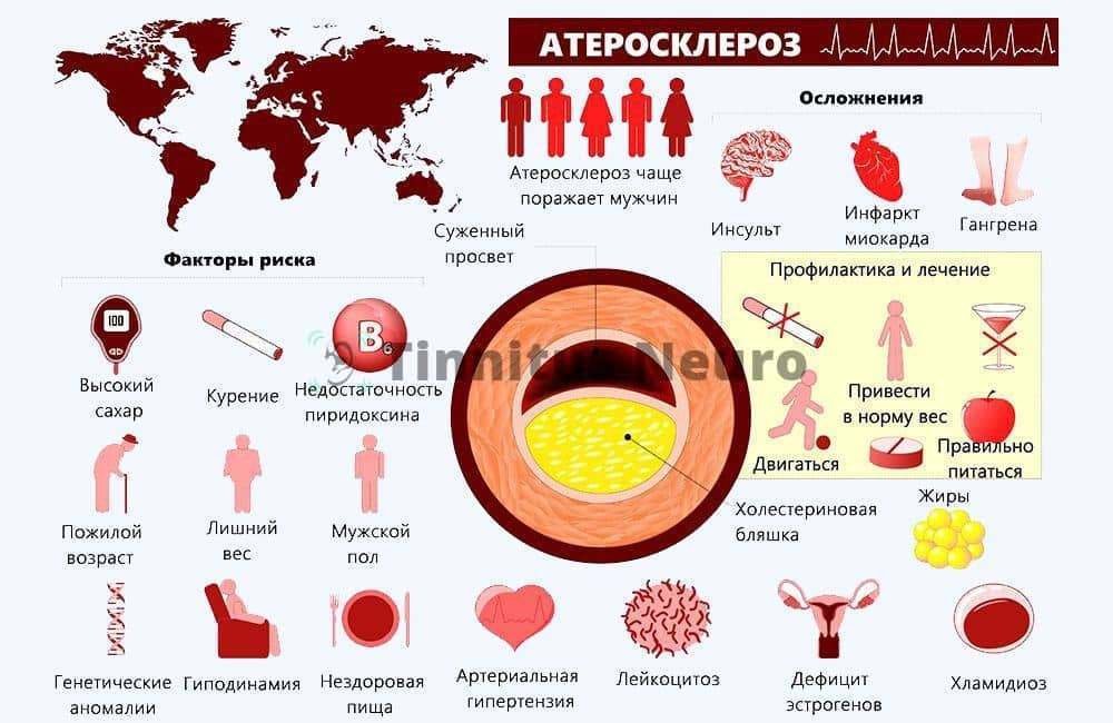 Атеросклероз сосудов шеи сонных артерий