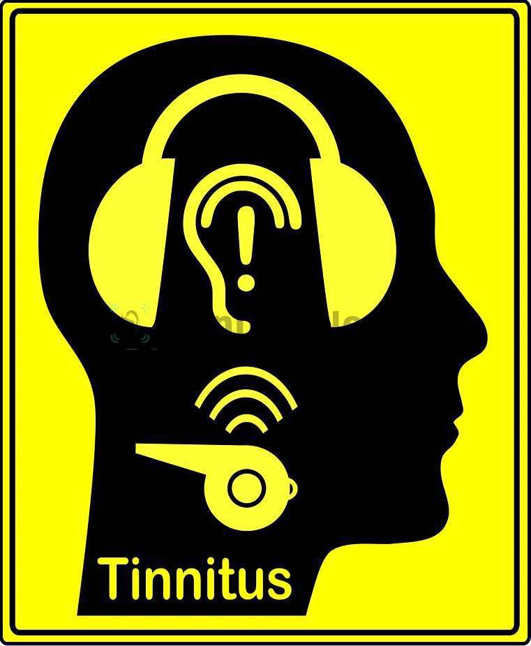 Причинами звона в голове и ушах становятся разные состояния
