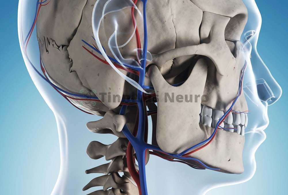 Шум венозной крови мы начинаем слышать из-за патологии сосудистого русла