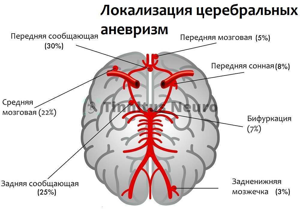 Вытащи себя за волосы!