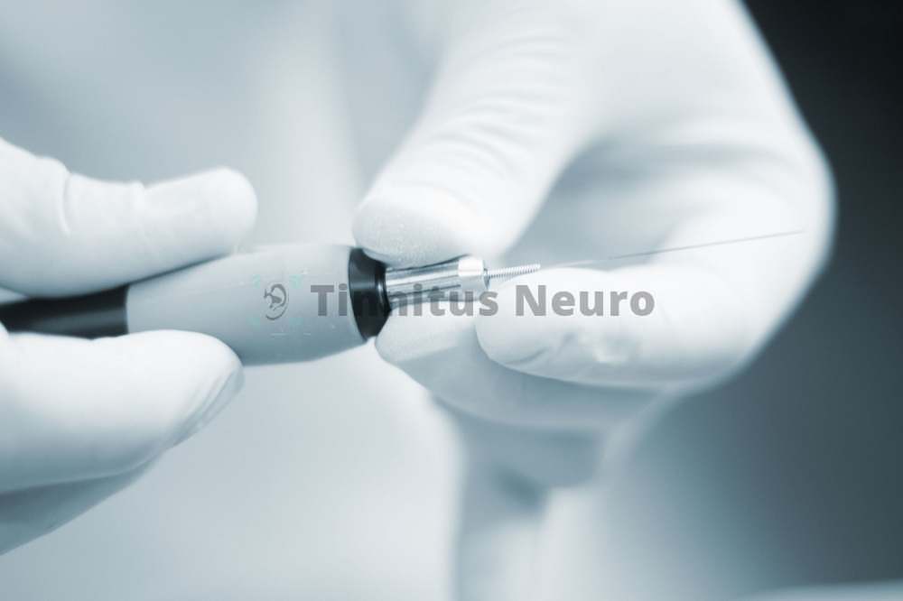 Микротоковая рефлексотерапия проводится микроэлектродами