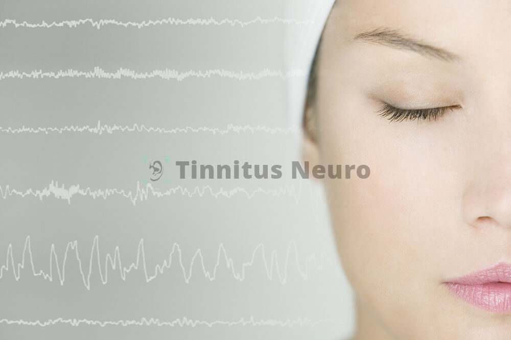 Диагностика проблем мозга на ЭЭГ