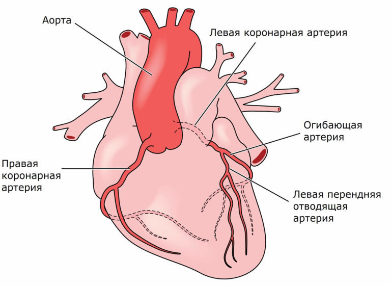 Интермедиарная артерия на рисунке