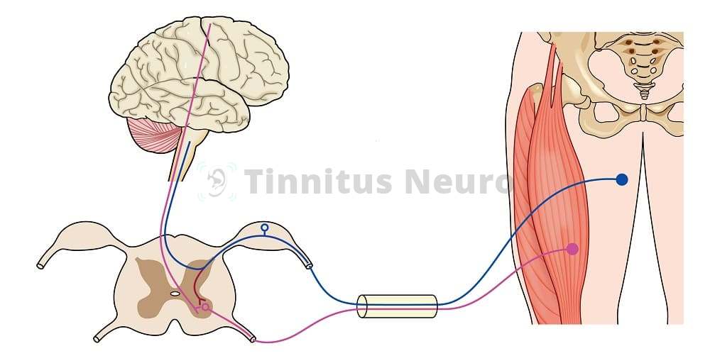 Электромиостимуляция в лечении тиннитуса