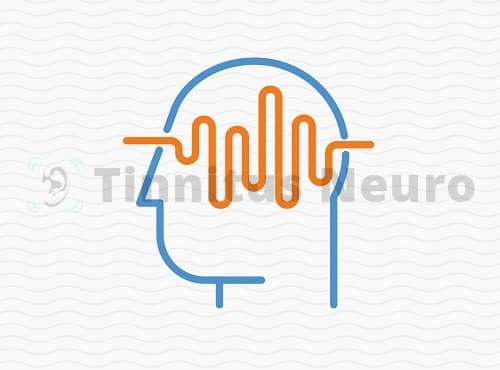 Крайне высокий частоты в лечении тиннитуса