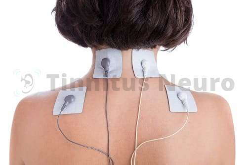 Стимуляция мышц шеи и спины в лечении тиннитуса